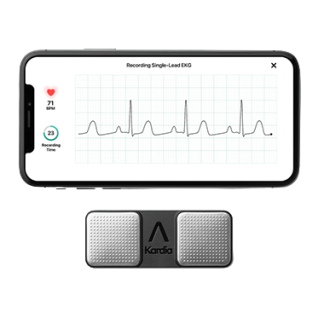 EKG